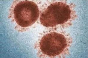 關(guān)于新冠肺炎的一切